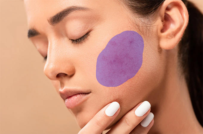 how to remove skin imperfection out of a picture